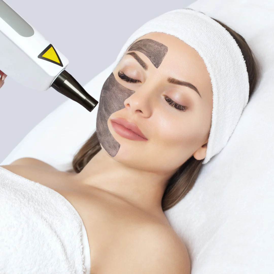 Carbon Laser Facial