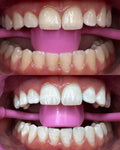 Advance Whitening 60Mins