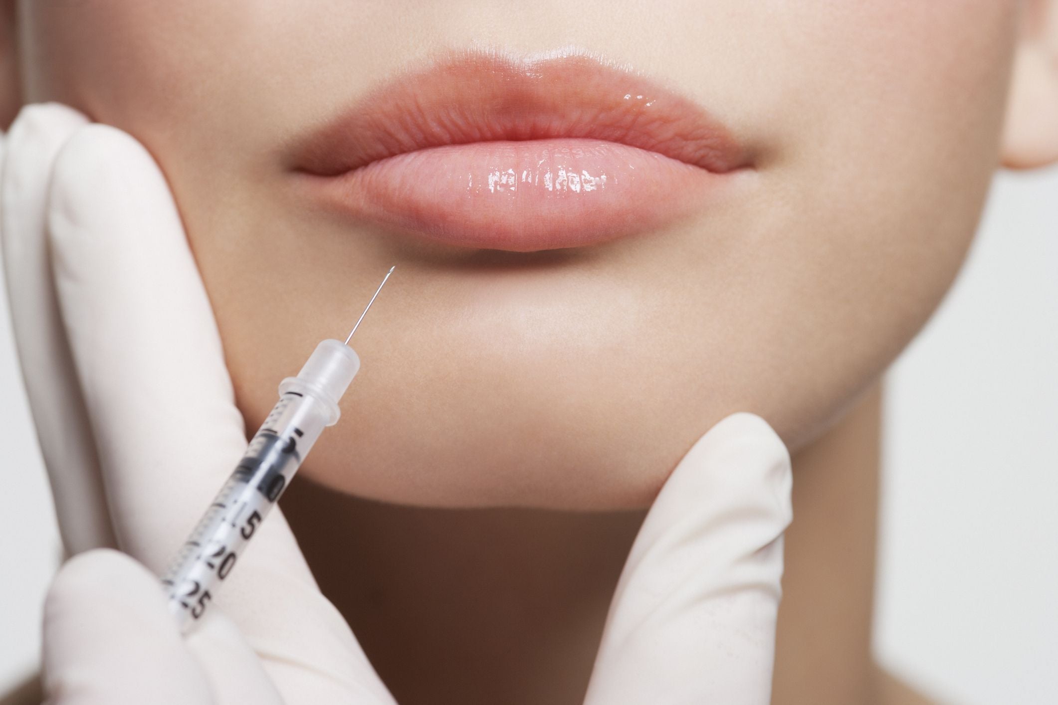 Lip Augmentation (0.5ml)